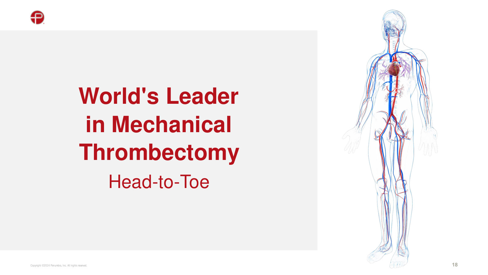 The positioning claim: head-to-toe mechanical thrombectomy across every major vascular territory.